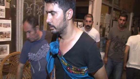 One of two victim of last Thursday's attack on activists at Camp Armen (Source: Hurriyet)  